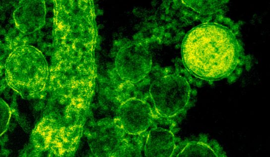 03.01.2023 о 15:00 – консультації щодо плiсняви